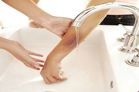 1459418512-bong-axit